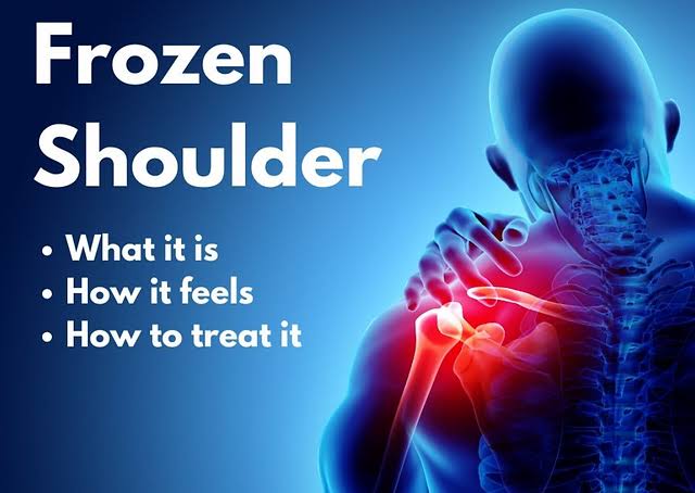 Frozen Shoulder Ayurveda Treatment: A Comprehensive Guide