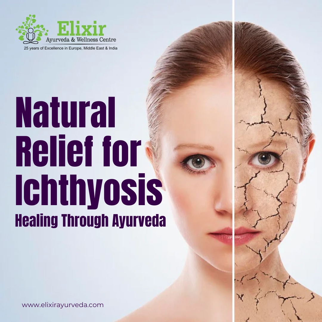 Natural Relief for Ichthyosis Healing Through Ayurveda